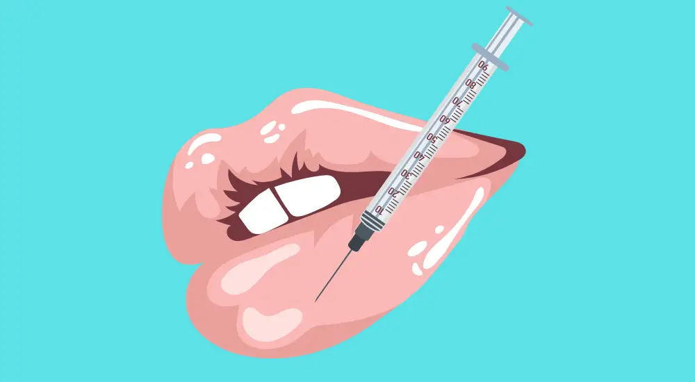 Lip filler injection - illustration