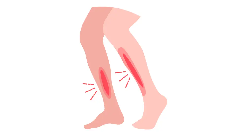 Shin pain from shin splints - illustration style diagram