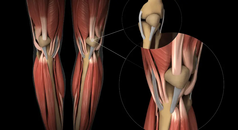 Tendonitis image showing tendons of the knee