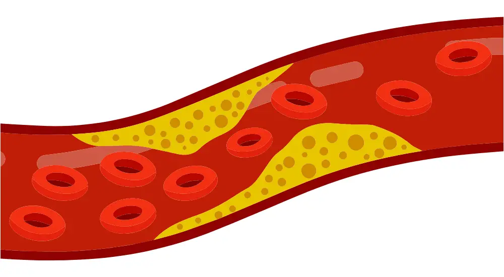 fat cells - illustration