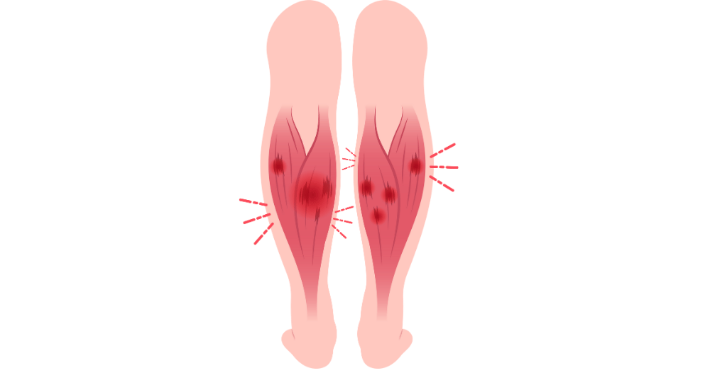 sore calf muscles